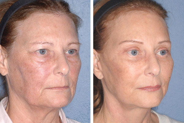 Best Plastic Surgeons in America, United States USA Best Plastic Surgeons in America One of The Worlds Best Plastic Surgeon plastic surgery before and after